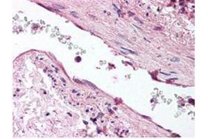 anti-ANG1 antibody was diluted 1:500 to detect ANG1 in human lung tissue. (Angiopoietin 1 抗体)