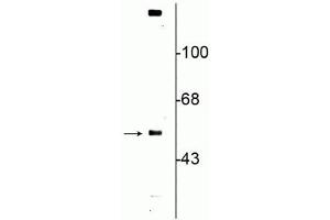Western blot of rat striatal lysate showing specific immunolabeling of the ~57 kDa VMAT2 protein. (SLC18A2 抗体  (C-Term))