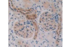 Immunohistochemistry (IHC) image for anti-Tumor Necrosis Factor Receptor Superfamily, Member 1A (TNFRSF1A) (AA 257-458) antibody (ABIN1860802)
