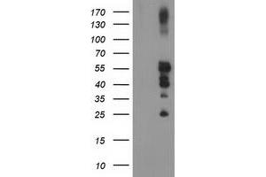 Western Blotting (WB) image for anti-Protein tyrosine Phosphatase, Non-Receptor Type 1 (PTPN1) antibody (ABIN1500496) (PTPN1 抗体)