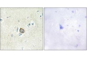 Immunohistochemistry analysis of paraffin-embedded human brain tissue, using CELSR3 Antibody. (CELSR3 抗体  (AA 91-140))