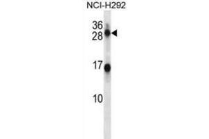 Western Blotting (WB) image for anti-Kallikrein 14 (KLK14) antibody (ABIN2998264) (Kallikrein 14 抗体)