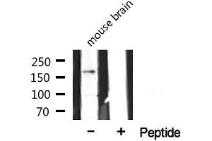 Western blot analysis of extracts from mouse brain, using CLASP1 antibody. (CLASP1 抗体  (Internal Region))