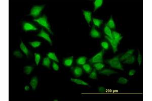 Immunofluorescence of  purified  MaxPab antibody to GENX-3414 on HeLa cell. (STBD1 抗体  (AA 1-358))