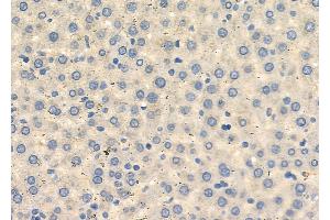 ABIN6262420 and ABIN6272672 at 1/100 staining Rat liver tissue by IHC-P. (HTR3D 抗体  (Internal Region))