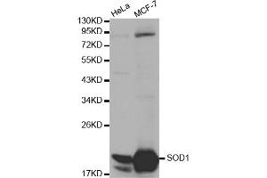 Western blot analysis of extracts of various cell lines, using SOD1 antibody (ABIN5970104) at 1/1000 dilution. (SOD1 抗体)