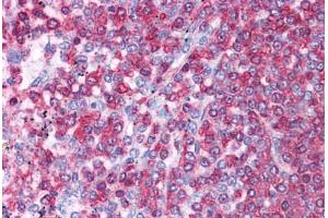 Human Spleen: Formalin-Fixed, Paraffin-Embedded (FFPE)