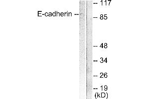 Western blot analysis of extracts from 293 cells, using E-cadherin antibody. (E-cadherin 抗体)