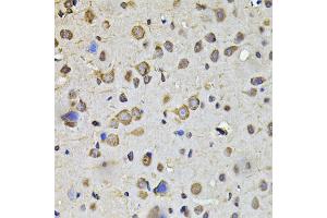 Immunohistochemistry of paraffin-embedded rat brain using HPGD antibody (ABIN2563240) at dilution of 1:100 (40x lens). (HPGD 抗体)