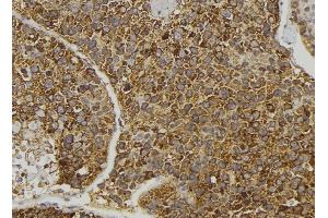 ABIN6274096 at 1/100 staining Human pancreas tissue by IHC-P. (EPH Receptor B6 抗体  (Internal Region))
