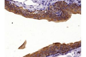 Paraformaldehyde-fixed, paraffin embedded Rat bladder Antigen retrieval by boiling in sodium citrate buffer (pH6. (Cytokeratin 1 抗体  (AA 141-240))