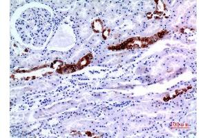 Immunohistochemistry (IHC) analysis of paraffin-embedded Human Kidney, antibody was diluted at 1:100. (KRT8 抗体  (Ser726, Ser731))