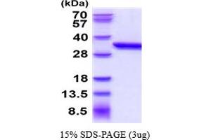 SDS-PAGE (SDS) image for Anthrax Toxin Receptor 2 (ANTXR2) (AA 32-318) protein (His tag) (ABIN6387780) (ANTXR2 Protein (AA 32-318) (His tag))
