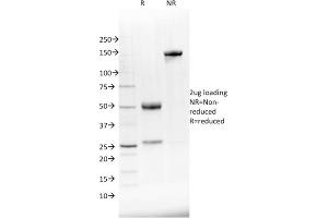 SDS-PAGE Analysis Purified NKX2. (NKX2-8 抗体  (AA 10-123))