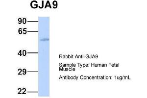 Host: Rabbit Target Name: GJA9 Sample Type: Human Fetal Muscle Antibody Dilution: 1. (GJA9 抗体  (Middle Region))
