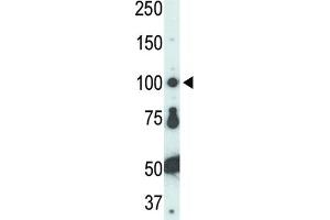 Western Blotting (WB) image for anti-FER Tyrosine Kinase (FER) antibody (ABIN3003442) (FER 抗体)