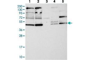 Western blot analysis of Lane 1: RT-4, Lane 2: U-251 MG, Lane 3: Human Plasma, Lane 4: Liver, Lane 5: Tonsil with RNF44 polyclonal antibody  at 1:250-1:500 dilution. (RNF44 抗体)
