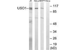 Western blot analysis of extracts from MCF-7/HeLa/Jurkat cells, using USO1 Antibody. (USO1 抗体  (AA 913-962))