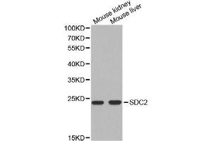 Western blot analysis of extracts of various cell lines, using SDC2 antibody. (Syndecan 2 抗体  (AA 19-144))