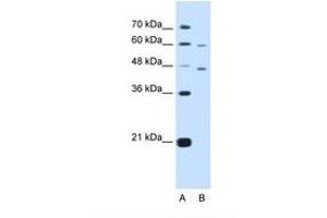 Image no. 1 for anti-Cysteine-Rich with EGF-Like Domains 1 (CRELD1) (AA 311-360) antibody (ABIN320904) (CRELD1 抗体  (AA 311-360))