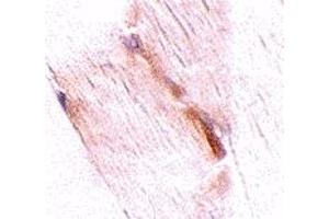 Immunohistochemistry (IHC) image for anti-Glioblastoma Amplified Sequence (GBAS) (Middle Region) antibody (ABIN1031016) (GBAS 抗体  (Middle Region))