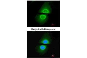 ICC/IF Image Immunofluorescence analysis of paraformaldehyde-fixed HeLa, using Cytochrome P450 4A11, antibody at 1:200 dilution. (CYP4A11 抗体  (Center))