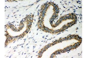 Anti- ERAB Picoband antibody,IHC(P) IHC(P): Human Mammary Cancer Tissue (HSD17B10 抗体  (AA 48-261))
