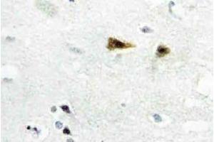 Immunohistochemistry analysis of c-Abl Antibody in paraffin-embedded human brain tissue. (ABL1 抗体)