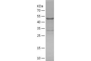 Western Blotting (WB) image for Synaptic Ras GTPase Activating Protein 1 (SYNGAP1) (AA 71-340) protein (His-IF2DI Tag) (ABIN7283932) (SYNGAP1 Protein (AA 71-340) (His-IF2DI Tag))