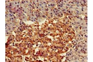Immunohistochemistry of paraffin-embedded human pancreatic tissue using ABIN7153185 at dilution of 1:100 (FZD4 抗体  (AA 37-222))