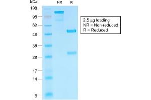 SDS-PAGE Analysis of Purified hCG beta Rabbit Recombinant Monoclonal Antibody (HCGb/1985R). (Recombinant CGB 抗体)