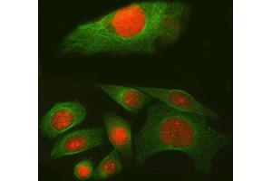 IF analysis of SPAG7 using anti-SPAG7 antibody (ABIN7599072) and anti-Tubulin Alpha antibody (ABIN7600339).