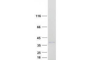 Western Blotting (WB) image for Occludin/ELL Domain Containing 1 (OCEL1) protein (Myc-DYKDDDDK Tag) (ABIN2727863)