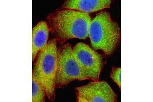 Fluorescent confocal image of  cell stained with RELA Antibody (Center) (ABIN1881740 and ABIN2838805). (NF-kB p65 抗体  (AA 166-195))
