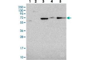 Western blot analysis of Lane 1: RT-4, Lane 2: U-251 MG, Lane 3: Human Plasma, Lane 4: Liver, Lane 5: Tonsil with ALDH1A3 polyclonal antibody  at 1:250-1:500 dilution.