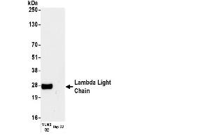 Western Blotting (WB) image for Rabbit anti-Human lambda Light Chain (Lambda-IgLC) antibody (ABIN7447487)