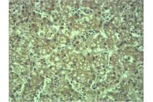Immunohistochemistry (IHC) analysis of paraffin-embedded Mouse Liver Tissue using EPG5 Polyclonal Antibody. (EPG5 抗体)