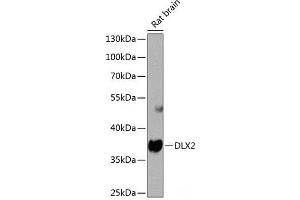 Western blot analysis of extracts of Rat brain using DLX2 Polyclonal Antibody at dilution of 1:1000. (DLX2 抗体)