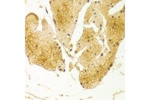 Immunohistochemistry of paraffin-embedded Human esophageal using BSG antibody at dilution of 1:100 (x400 lens). (CD147 抗体  (AA 30-200))