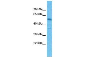 Host:  Rabbit  Target Name:  TMEFF2  Sample Type:  Colorectal Tumor lysates  Antibody Dilution:  1.