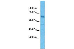 Host:  Rabbit  Target Name:  TMEFF2  Sample Type:  Colorectal Tumor lysates  Antibody Dilution:  1. (TMEFF2 抗体  (C-Term))