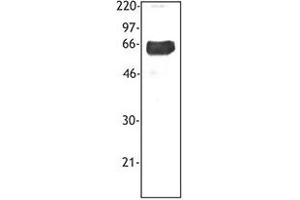 Image no. 1 for anti-Triggering Receptor Expressed On Myeloid Cells 1 (TREM1) antibody (ABIN205544) (TREM1 抗体)