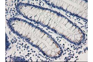 Immunohistochemistry (IHC) image for anti-Cyclin-Dependent Kinase 2 (CDK2) antibody (ABIN1497394) (CDK2 抗体)