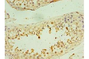 Immunohistochemistry of paraffin-embedded human testis tissue using ABIN7171237 at dilution of 1: 100 (STX3 抗体  (AA 1-263))