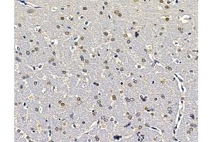 ABIN7096457 and ABIN7100521 at 1/100 staining rat brain tissue by IHC-P.