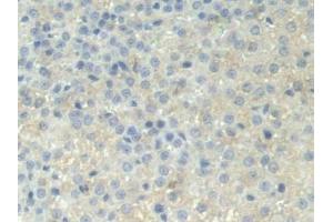 DAB staining on IHC-P; Samples: Rat Adrenal gland Tissue (PPOX 抗体  (AA 9-300))