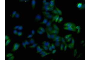 Immunofluorescence staining of HepG2 cells with ABIN7173778 at 1:50, counter-stained with DAPI. (TNFAIP8L1 抗体  (AA 1-186))