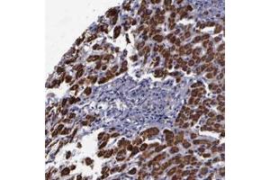 Immunohistochemical staining (Formalin-fixed paraffin-embedded sections) of human liver with MAP3K9 polyclonal antibody  shows strong cytoplasmic positivity in hepatocytes. (MAP3K9 抗体)