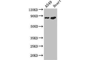 Western Blot Positive WB detected in: A549 whole cell lysate, Mouse heart tissue All lanes: PFKM antibody at 3. (PFKM 抗体  (AA 166-334))