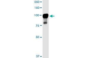 MARK2 monoclonal antibody (M01), clone 3B12. (MARK2 抗体  (AA 401-500))